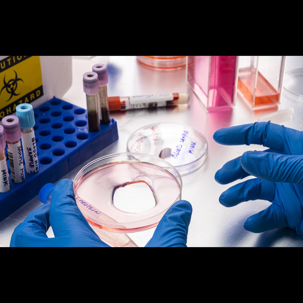 E. Coli Recombinant Hepatitis B virus genotype C subtype ayw Capsid protein ''HBcAg''